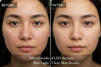 SelvaCare™ Radiant Skin LED Therapy (7-Color Face + Neck Mask)