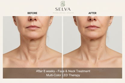 SelvaCare™ Radiant Skin LED Therapy (7-Color Face + Neck Mask)